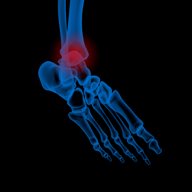 Disturbi del piede e della caviglia